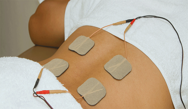 sEMG-triggered NMES unit and electrode placement